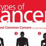 Forms of Cancer